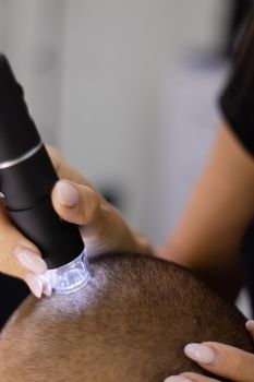 Trichoscope examination of hair, scalp and hair follicles of a young man. Copy space. The head of a man with thinning hair during the Trichology.