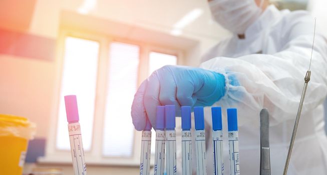 doctor hand taking a blood sample tube from a rack with machines of analysis in the lab background. Technician holding blood tube test in the research laboratory