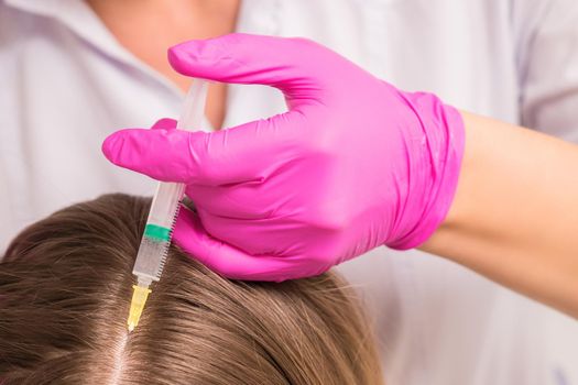 Close up of doctor cosmetologist making mesotherapy injections in head of woman. Concept of mesotherapy.