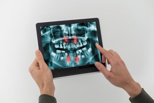 Discussing issues. Cropped shot of a professional dentist showing jaws and teeth x-rays to his patient using a digital tablet technology gadget online issues healthcare medical profession help concept