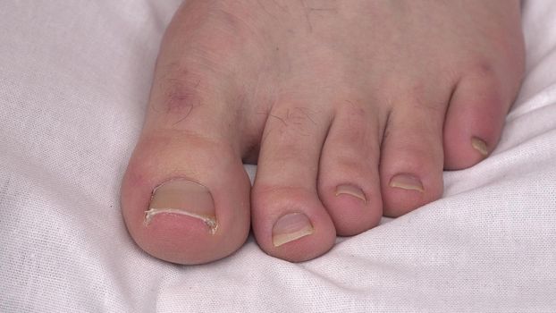A man cuts his toenails close-up. 4k