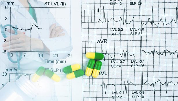 EKG or ECG graph report paper. EST result and green-yellow capsule pills with cardiologist specialist doctor wear white uniform. Physician stand with arms crossed and hand holding stethoscope.