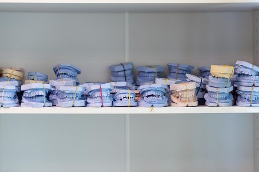 Dental gypsum models cast of a human dental jaw. Gypsum models lie on a shelf in a row. Laboratory prosthetics. Close-up shot. Shelf with lying on her casts of teeth and prosthetic and restorations