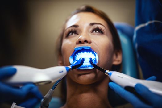 The beautiful young woman is at the dentist. She sits in the dentist's chair and the dentist sets braces on her teeth putting aesthetic self-aligning lingual locks with an infrared lamp.