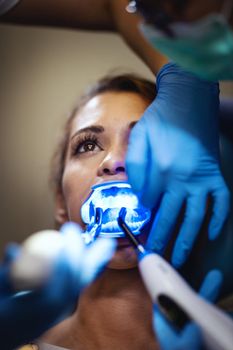 The beautiful young woman is at the dentist. She sits in the dentist's chair and the dentist sets braces on her teeth putting aesthetic self-aligning lingual locks with an infrared lamp.