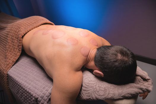 Close-up of a man's back after application glass vacuum cans installed in a dark room of a spa salon.