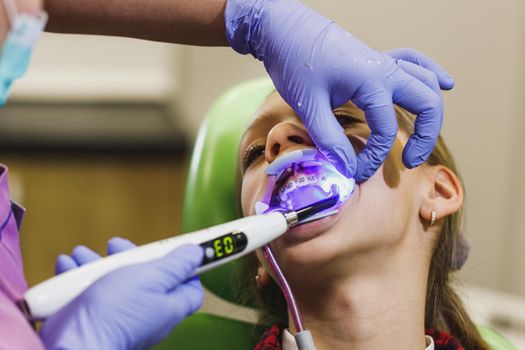 The little girl is at the dentist. She sits in the dentist's chair and the dentist sets braces on her teeth with an infrared lamp.