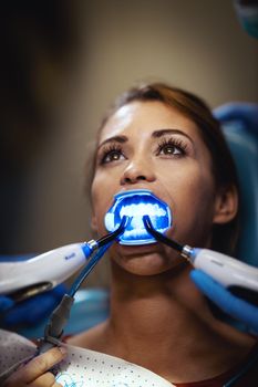 The beautiful young woman is at the dentist. She sits in the dentist's chair and the dentist sets braces on her teeth putting aesthetic self-aligning lingual locks with an infrared lamp.