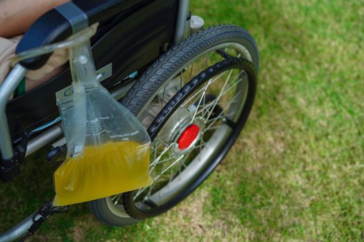 Asian disability woman with urine bag on wheelchair.