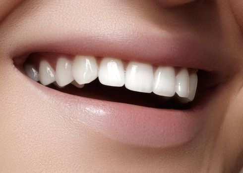 Beautiful smile with whitening teeth. Dental photo. Macro closeup of perfect female mouth, lipscare rutine.