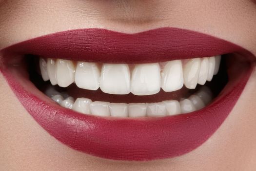 Beautiful smile with whitening teeth. Dental photo. Macro closeup of perfect female mouth, lipscare rutine.