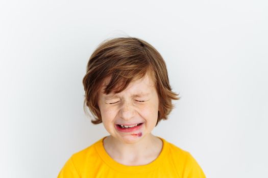 Portrait of school boy kid child crying due to sore bruised wound on his face. Caucasian schoolboy in yellow t-shirt crying of pain as he hurt his face on white background with copy space for text.