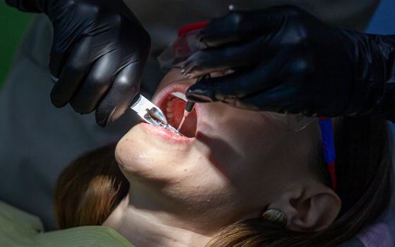 The process of removing braces. A beautiful woman in protective glasses in a dental chair during the procedure of removing braces from teeth. Dentist and assistant working.