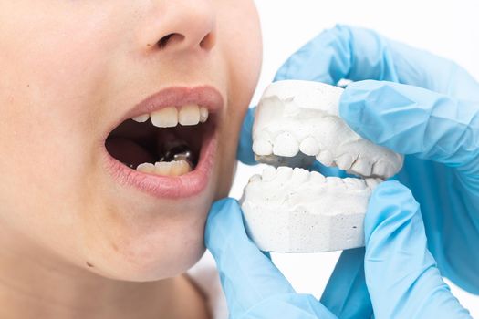 Orthodontist's hand, covered in a blue medical glove holding a dental mold of the lower jaw. The teeth seem a little crooked