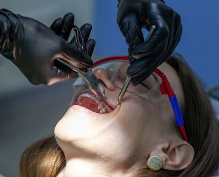 The process of removing braces. A beautiful woman in protective glasses in a dental chair during the procedure of removing braces from teeth. Dentist and assistant working.