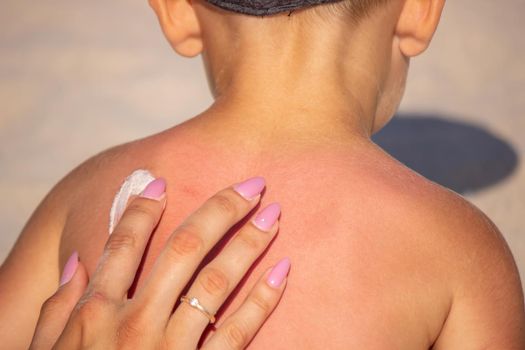 Mom puts sunscreen on Sin's back in the shape of a heart. selective focus