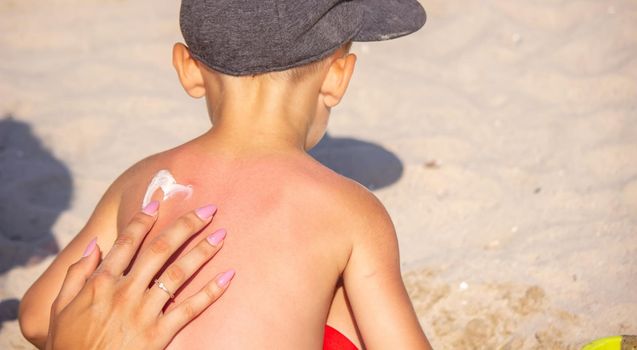 Mom puts sunscreen on Sin's back in the shape of a heart. selective focus