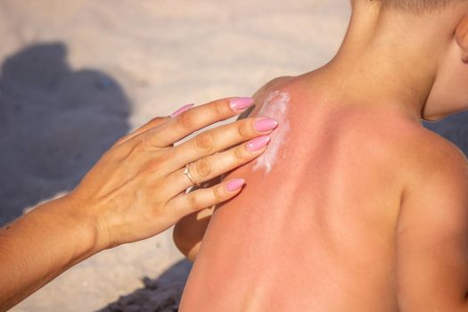 Mom puts sunscreen on Sin's back in the shape of a heart. selective focus