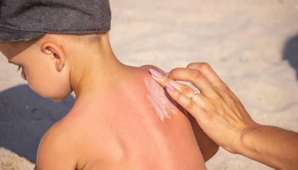 Mom puts sunscreen on Sin's back in the shape of a heart. selective focus