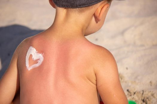 Mom puts sunscreen on Sin's back in the shape of a heart. selective focus