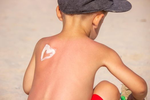 Mom puts sunscreen on Sin's back in the shape of a heart. selective focus