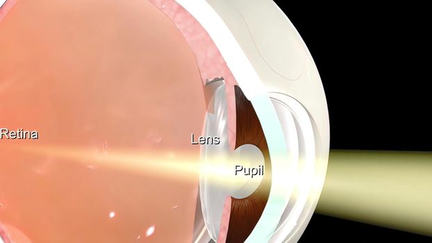 Common causes of sudden vision loss include eye trauma, obstruction of blood flow to the retina, and pulling of the retina away from its normal position at the back of the eye. 3D illustration