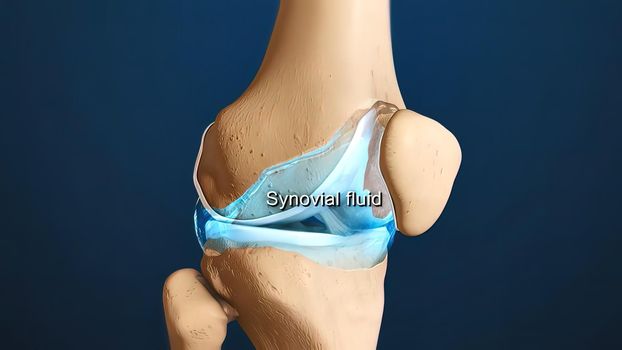 Cross section through a typical synovial joint showing the bone synovial membrane synovial fluid cartilage and ligament 3d illustration