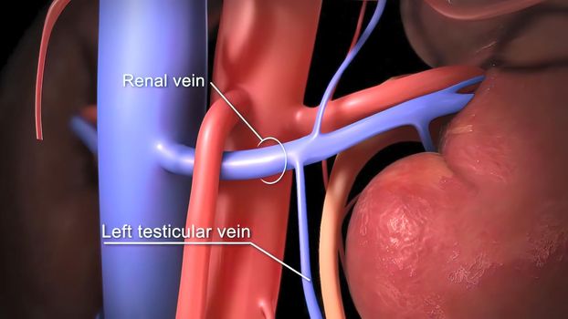 The right testicular vein attaches to the inferior vena cava. The left vein drains into the left renal vein. 3D illustration