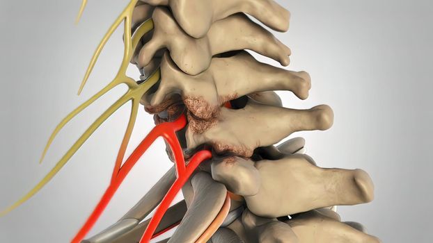 The lumbar spine refers to the lower back, where the spine curves inward toward the abdomen. 3d illustration