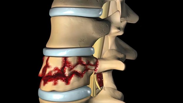 Cervical nerve roots exit the cervical spine through the intervertebral foramina between the vertebrae. 3D illustration