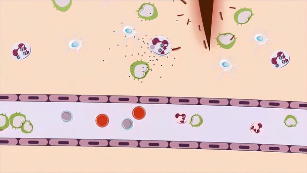 Damaged cells release chemicals such as histamine, bradykinin, and prostaglandins. 3D illustration