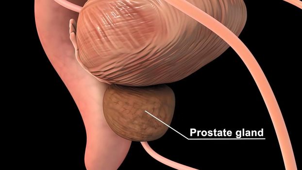 The prostate is located just below the bladder and in front of the rectum. It is about the size of a walnut and surrounds the urethra. 3D illustration