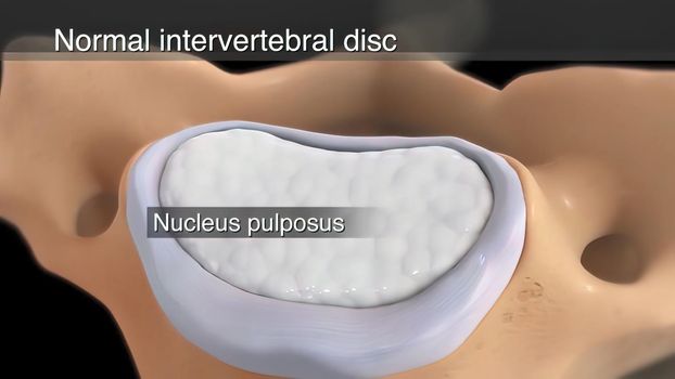 Spinal cord , normal intervertebral disc 3D illustration