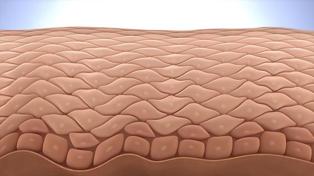 Hyperkeratinization is a disorder of the cells lining the inside of a hair follicle. It is the normal function of these cells to detach or slough off from the skin lining at normal intervals. 3D illustration