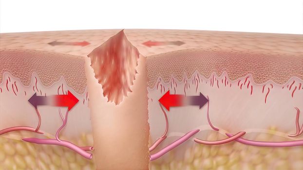 It typically lasts around three weeks for minor wounds, and its the time when the body repairs broken blood vessels and replaces damaged tissues with healthy new ones. 3D illustration