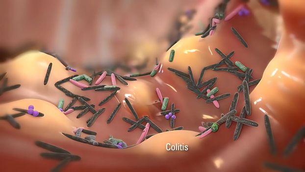 The immune response is how your body recognizes and defends itself against bacteria, viruses, and substances that appear foreign and harmful to the body. 3D illustration