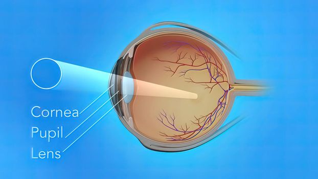 3D illustration Eye's Anatomy, Wet Macular Degeneration