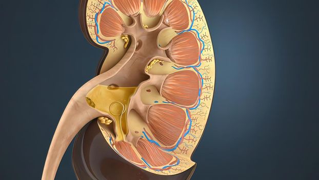 Lithotripsy treats kidney stones by sending focused ultrasonic energy or shock waves directly to the stone first located with fluoroscopy 3D illustration