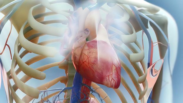 Heart failure means that the heart is unable to pump blood around the body properly. 3D illustration