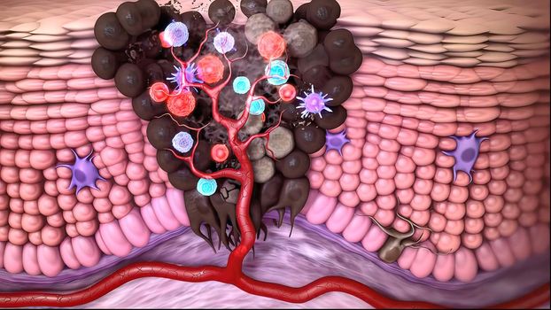 Antibodies destroy an infected cell by a virus, immun defense kill the infected cell 3D illustration