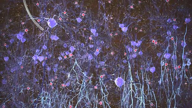 3D Medical illustration of microglial cell growth in the brain 3D illustration