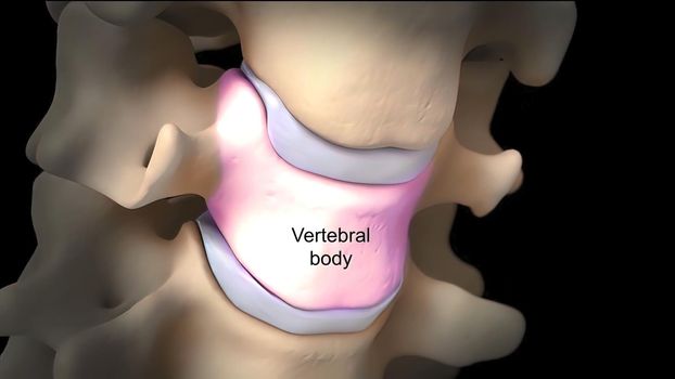 Cervical nerve roots exit the cervical spine through the intervertebral foramina between the vertebrae. 3D illustration