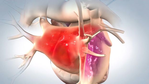 Systole, period of contraction of the ventricles of the heart that occurs between the first and second heart sounds of the cardiac cycle. 3d illustration