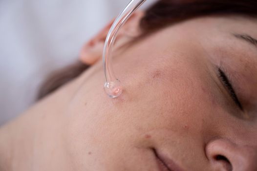 The doctor uses the darsonval apparatus against acne on the face of a female patient