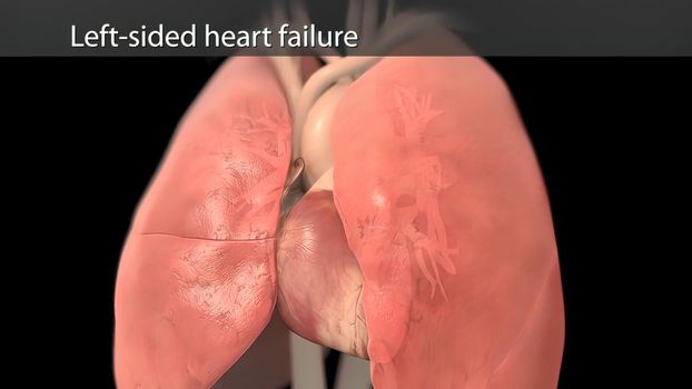 Left atrium, one of the four chambers of the heart. The left atrium receives blood full of oxygen from the lungs and then empties the blood into the left ventricle 3D illustration