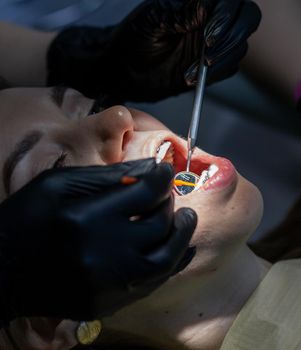 Installing a retainer after wearing braces. The process of removing braces.Beautiful woman in dental chair during procedure of installing braces to upper and lower teeth. Dentist and assistant working