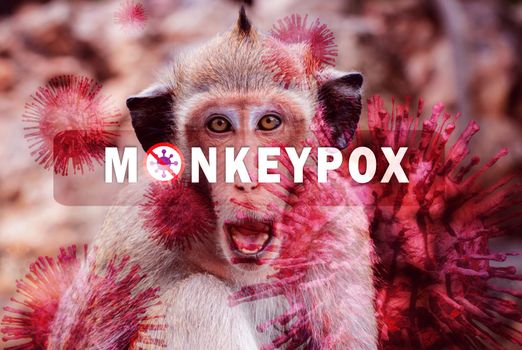 Monkeypox outbreak concept. Monkeypox is caused by monkeypox virus. Monkeypox is a viral zoonotic disease. Virus transmitted to humans from animals. Monkeys may harbor the virus and infect people.