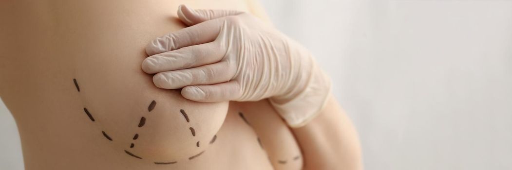 Close-up of female with marking on boobs for cosmetic surgery procedure, ready for bigger breasts, final step before surgery. Modern medicine, beauty, plastic, cosmetic surgery concept