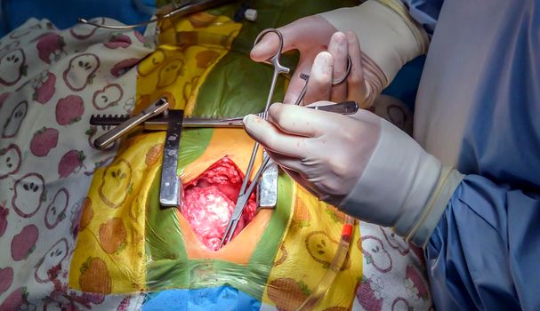 Ross's operation is the surgical treatment of aortic valve defects.