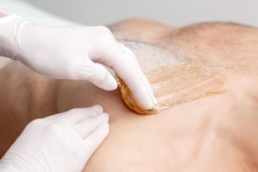 Epilation chest of young male with liquid wax paste by hands of female cosmetologist in beauty salon